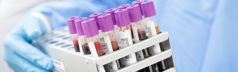 Gloved hands holding a rack of purple-capped blood collection tubes with barcode labels